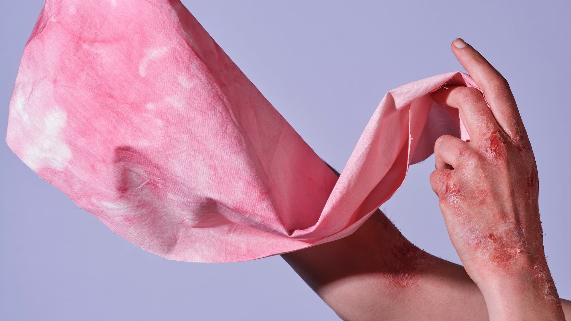 Empowering Skin Wellness through Bio-Inspired Textile Innovation